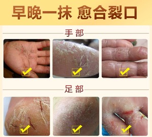 脚跟龟裂后跟干裂皲裂防裂膏脚开裂手脚裂手足裂口脱皮愈裂霜套餐