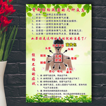 Beauty salon decoration wall hanging painting poster health hall back meridian dredging reaction symptoms traditional Chinese medicine hall wall chart