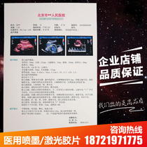 Medical film A4 porcelain white inkjet color Super Four-dimensional B ultra-translucent laser dry film printing paper