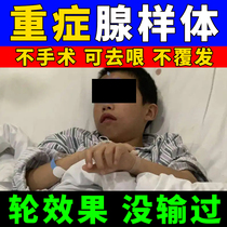 (Exclusive) gonad-like body hypertrophy traditional Chinese medicine post-conditioning childrens nasal plug Zhang mouth breathing and snoring face straightener