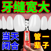 牙缝宽大(闭合牙缝)修复牙龈萎疼缩敏感固齿牙齿松动牙痛牙膏