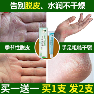 手脚脱皮膏手指掌季节性蜕皮干燥粗糙防干裂开裂非特效滋养修复霜