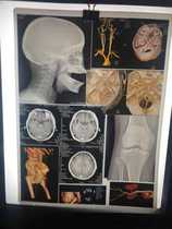 Porcelain White A3 medical color laser inkjet double-sided printing CT 3D reconstruction DR CR X-ray film nuclear magnetic