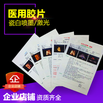 B5 16K A4 porcelain white laser printing film))B ultrasonic laser film) double-sided printing porcelain white film