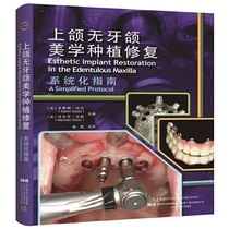 Systematic guide for aesthetic implant restoration of edentulous maxilla