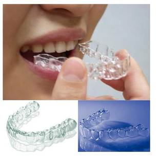 进口隐形牙齿保持器定做 正畸矫正防反弹 配牙套盒自寄牙模 包邮