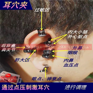 耳穴夹按摩夹持器抓点穴按压探针棒非不留豆贴珠耳朵穴位理疗工具