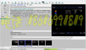 索图超声软件B超软件B超工作站软件彩超软件B超软件win7/win10版