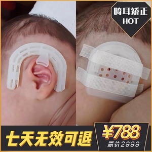 新生儿耳廓矫正器硅胶带婴儿耳朵畸形宝宝耳朵定型贴垂耳耳夹塑形