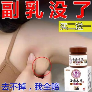 副乳贴消除腋下淋巴结去副乳神器消淋巴疏通乳腺耳后肿大散结节膏