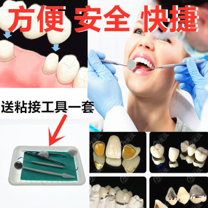 牙科粘烤瓷牙冠粘接胶水牙齿钢牙套牙冠假牙专用牙科胶水粘接剂