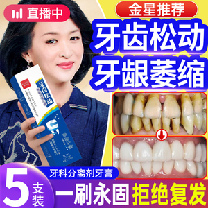 【102%治好】牙齿松动固齿专用牙膏牙科分离剂牙膏龈萎修复缩再生