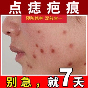 点痣去疤痕后修复除疤膏脸部淡化痘印红红印修复疤印凹痕沉淀药膏