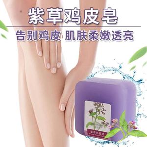 紫草鸡皮香皂去除鸡皮角质男女洁面洗脸深层清洁全身洗澡沐浴肥皂