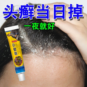 头皮屑脂溢性皮炎真菌感染头癣药膏治疗头部头痒毛囊炎专用特效药