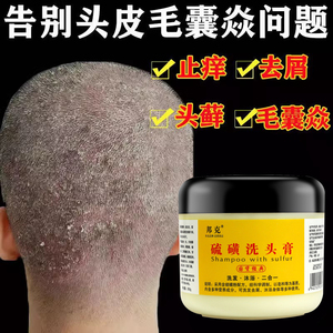 上海硫磺皂洗头膏升级款去屑头屑止痒中药洗发水硫黄皂正品旗舰店