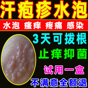 疱珍专用软膏手上小水泡疱泡疹汗药膏真菌感染汗状汗孢疹手气药膏