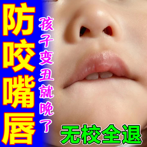 宝宝防咬下嘴唇神器戒婴儿童咬嘴唇矫正器防止小孩子吸咬下嘴唇膏