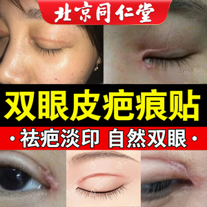 双眼皮术后疤痕贴防增生去医用巴痕贴硅酮凝胶疤克祛疤膏双眼皮lx