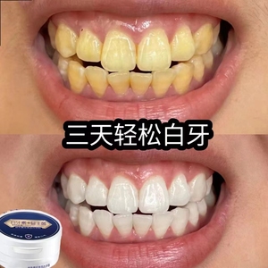 【牙医推荐】益生菌美白牙粉亮白牙齿去牙黄牙黑去烟茶渍去牙结石