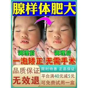 腺样体肥大泡脚中药包矫正调理儿童宝宝鼻炎防止孩子张嘴睡觉克星