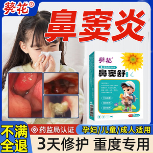 儿童鼻窦炎中药贴鼻贴热敷膏药过敏性鼻炎鼻塞通鼻专用‮药根治疗