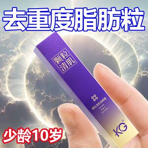 KG眼霜去除脂肪粒汗管粒油脂粒神器眼周脸部专用去扁平粒淡化眼袋