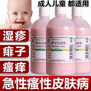 炉甘石洗剂驴甘石沪炉乳甘石洗剂炉粉剂婴儿童抑菌液涂剂孕妇医用