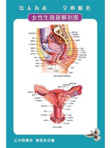 妇科疾病挂图宫颈HPV宣传海报女性生殖系统海报宫颈疾病示意图