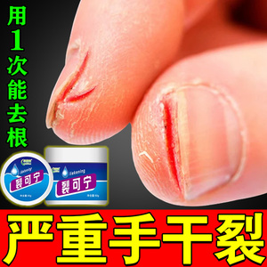 手指裂口子指甲缝勒口脚趾皲裂膏秋冬季皲裂开裂手指干燥粗糙裂口