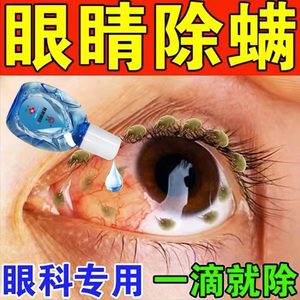 眼睛除螨眼干痒干涩红血丝视线模糊去异物螨虫止痒眼睑清理眼药水