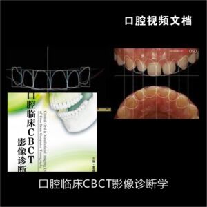 口腔临床CBCT影像诊断学 素材PDF电子版