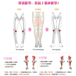 腿型矫正神器直腿o型腿x型腿内八字纠正成人儿童改变xo腿形绑腿带