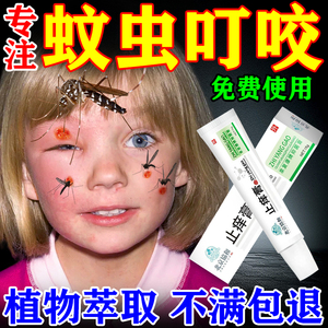 蚊虫叮咬快速止痒消肿药膏婴儿童宝宝成人专用防跳蚤臭虫日本神器