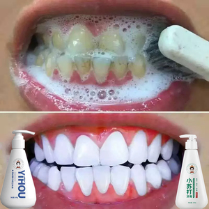 正品医后小苏打益生菌儿童牙膏酵素美白去黄牙垢虫牙黑牙去口臭