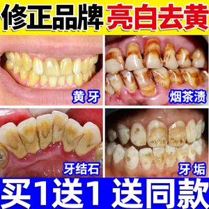洁牙粉可搭去黄洗白牙齿美白黄牙洗污垢去牙结石神器除牙垢牙烟渍