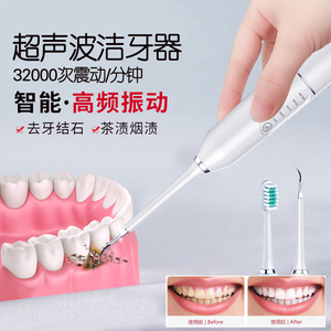 家用超声波洗牙器牙结石去除器牙齿污垢除牙石电动洁牙仪洁牙神器