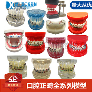 牙科口腔模型 透明错颌齿科展示模型 结扎丝托槽牙模带支抗钉牙列