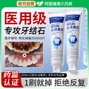 牙结石溶解牙石烟渍牙垢洗牙齿污垢非牙膏强力速效清除神器去除器