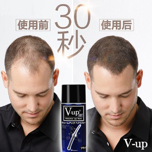 日本V-UP快速遮盖秃顶补发喷雾纤维碳粉头皮脱发增发浓密发假头发