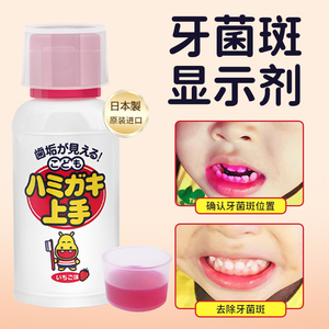 日本牙菌斑显示剂儿童牙膏去牙渍牙垢指示剂口腔牙菌斑去除神器