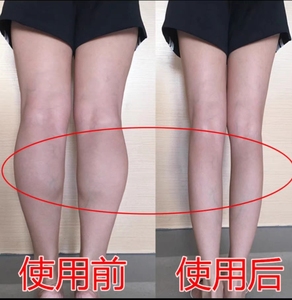 瘦肌肉腿神器大腿小腿燃烧减大象腿根部脂肪贴美腿机消除学生粗腿