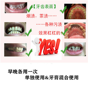 小苏打牙齿美白洗牙粉黄牙非神器速效去牙垢烟茶污渍牙结石洁牙素