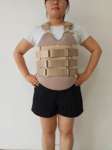 新款土豪金具透气矫形器术后护腰带胸椎脊椎腰椎骨折固定支架支具