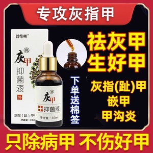 灰指甲治疗专用药水根治正品抑菌液手指甲脚趾甲亮甲抗真菌特效药旗舰店去根甲沟炎特效药膏指甲往肉里长黑指甲修复液受损再生