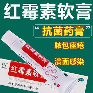 恒久远红霉素软膏8g抗菌消炎祛痘止痒罗红梅素软膏药私处女性外用