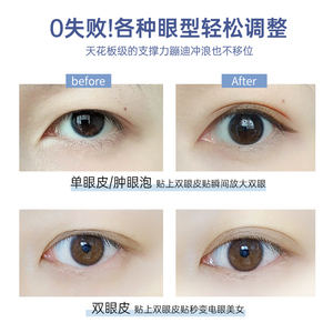 日本双眼皮贴自然隐形无痕双面埋线纤维条肿眼泡专用纳米双眼皮线
