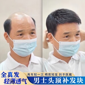 男士假发短发全真人发轻薄无痕遮盖头顶脱发地中海秃头男式补发片