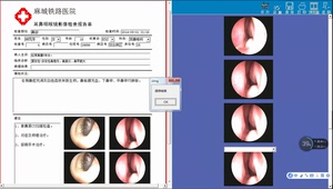 耳鼻喉工作站软件耳鼻喉镜支气管纤维镜软件内窥镜软件XPWin7版