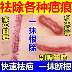 祛疤膏疤痕修复剖腹产去疤痕去除疙瘩淡化产后妊娠纹疤痕疙瘩疤痕